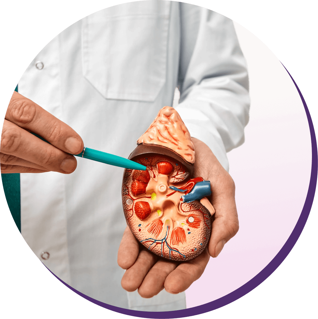 A physician in a white coat using a model of a kidney to show where kidney stones can appear