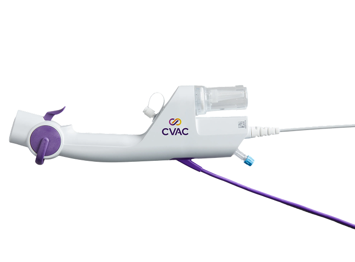 A picture of the handpiece for the CVAC System kidney stone treatment