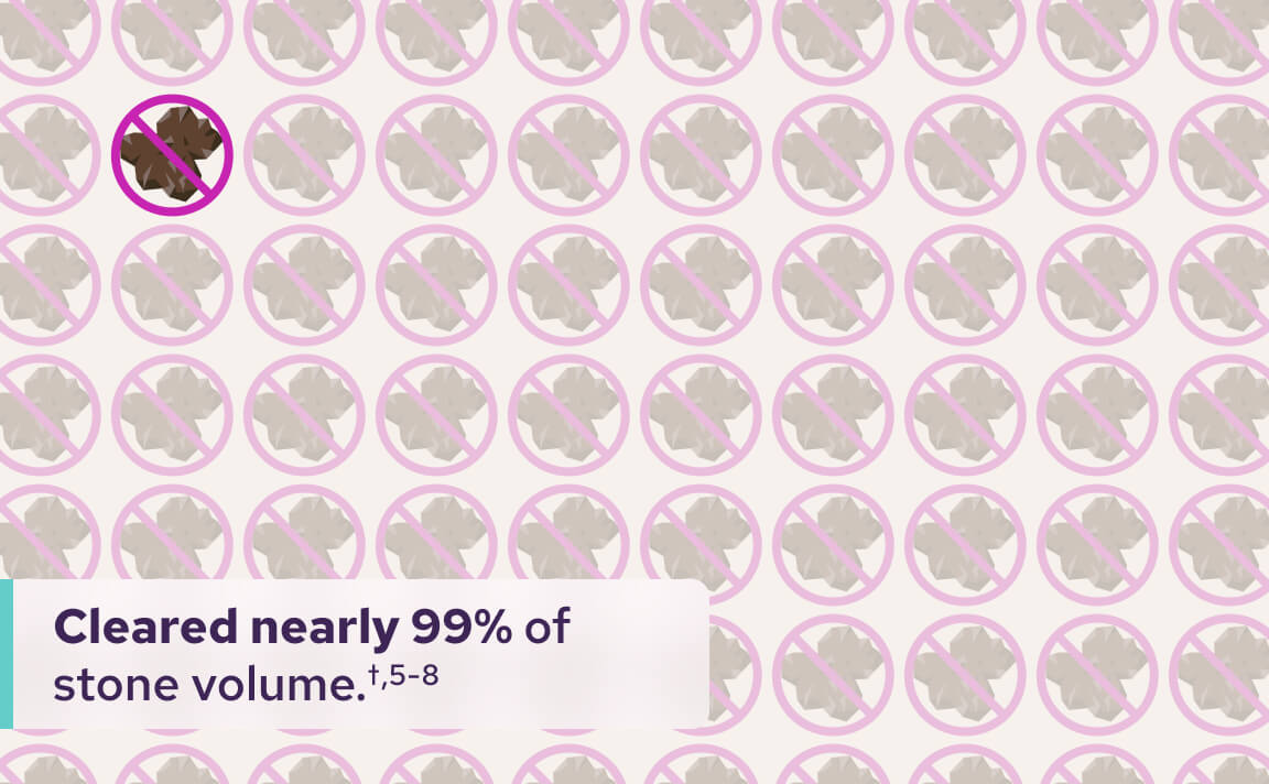 An infographic illustrating how effectively the CVAC System clears kidney stones
