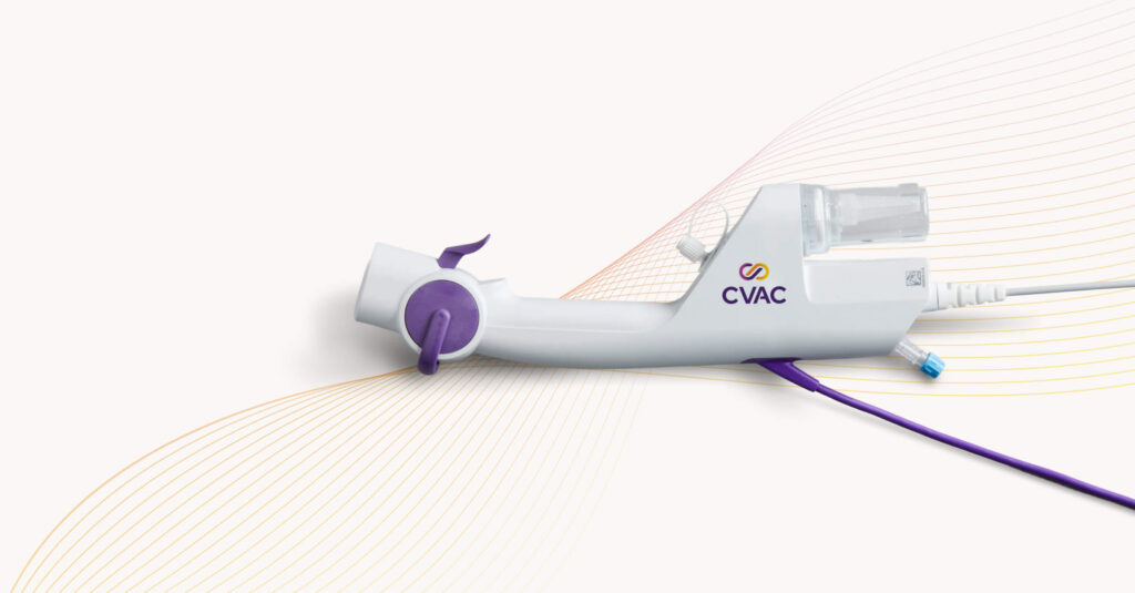 Kidney Stone Care | The CVAC System